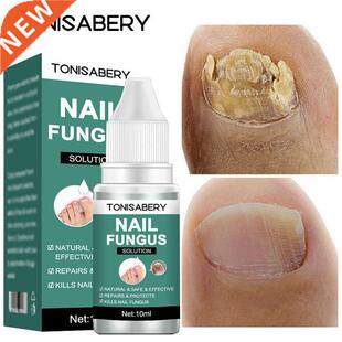 Nail Fungal Treatment Feet Care Essence Anti Infection Paro