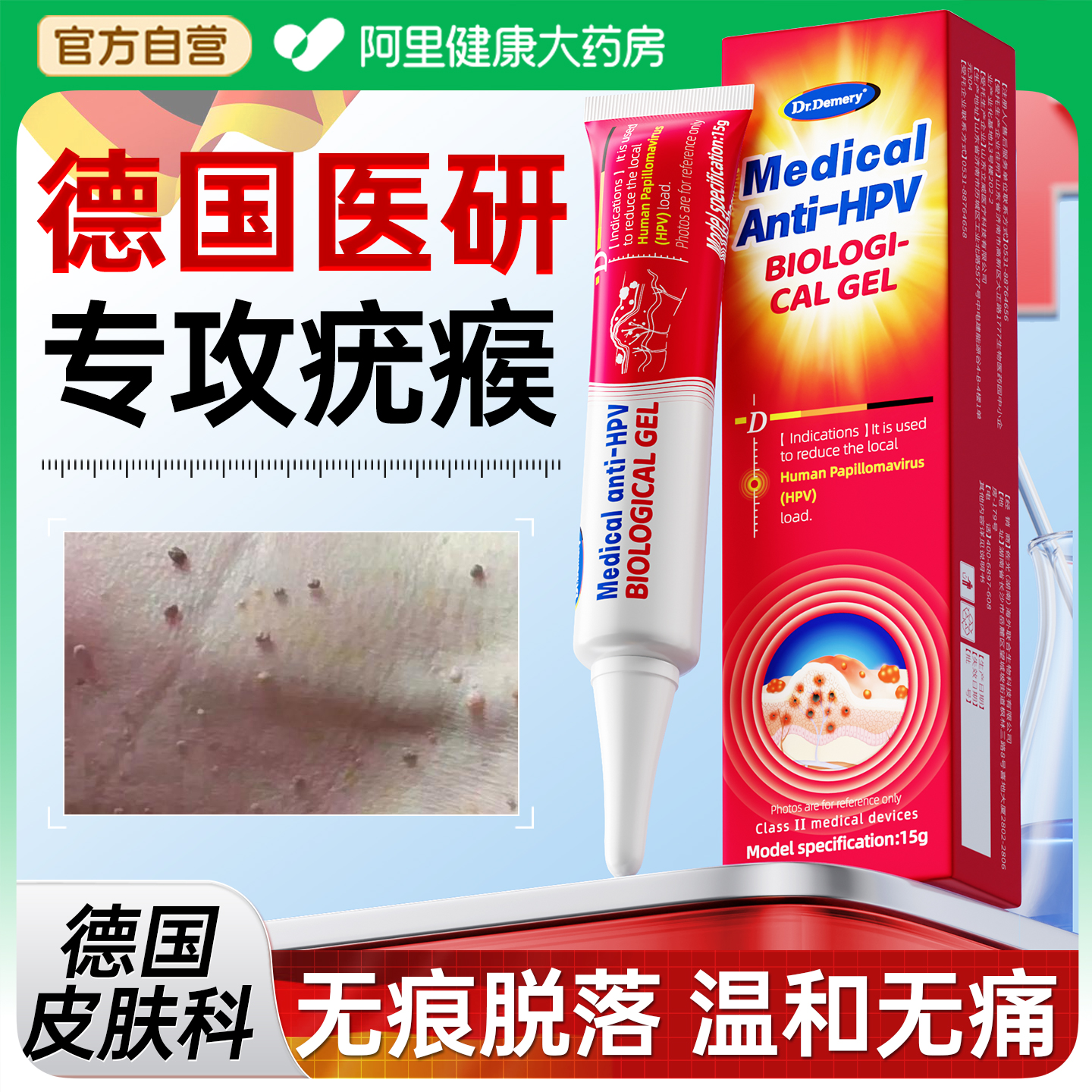 【德国技术】无痛脱疣瘊