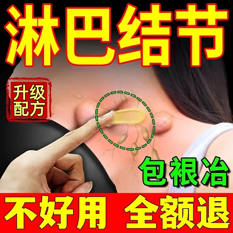 淋巴结消散膏去富贵包副乳消除贴神器颈部结节疏通经络肿大消炎药