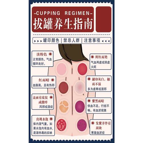 拔罐颜色辩健康海报中医调理美容院养生馆装饰图墙贴广告画