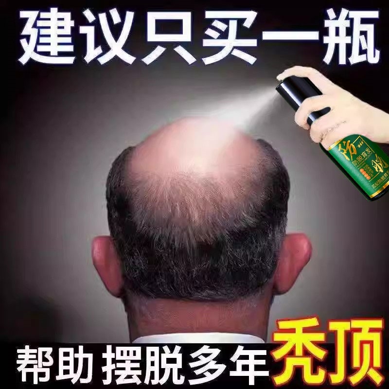 生髪液防脱育发增发密发男女生快其它护发