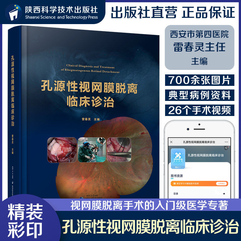 孔源性视网膜脱离临床诊治