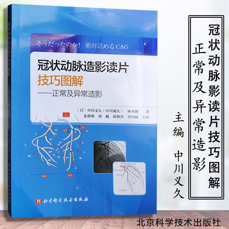 冠状动脉造影读片技巧图解 正常及异常造影冠脉造影图片技巧图解冠状动脉造影读片图解快速进阶PCI达人冠脉结构中川义久林秀隆