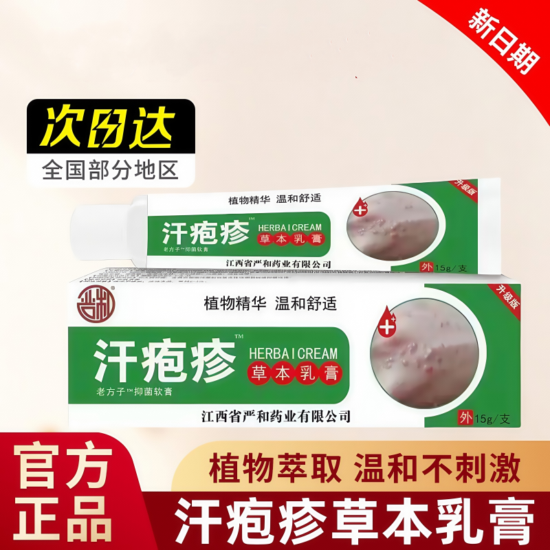 汗泡疱疹膏手上起小水泡孢疹专用软膏汗状止痒真菌感染汗泡疹膏