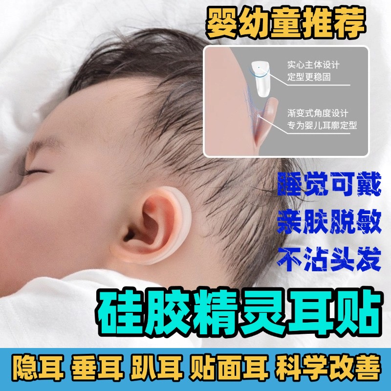硅胶婴儿耳朵矫正器新生儿耳贴