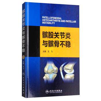 王飞 编髌股关节炎与髌骨不稳（正版旧书包邮）人民卫生出版社9787117242271