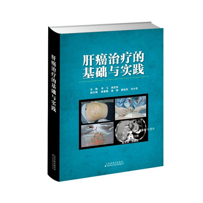 肝癌治疗的基础与实践李玉，曲宝林主编天津科技翻译出版公司9787543340374医学卫生/肿瘤学
