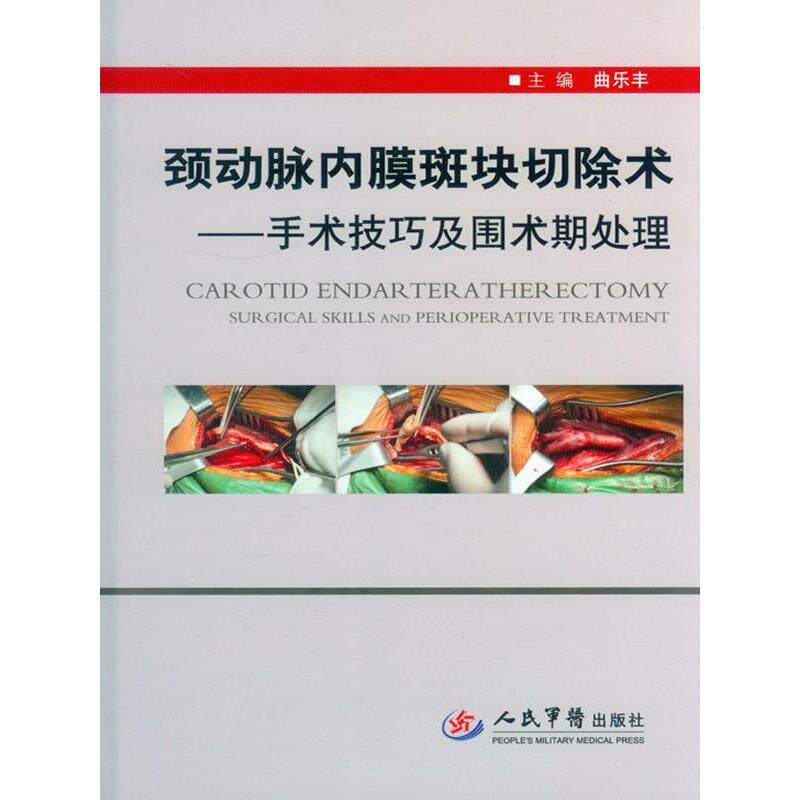 颈动脉内膜斑块切除术—手术技巧及围术期处理曲乐丰人民军医出版社9787509183243医学卫生/外科学