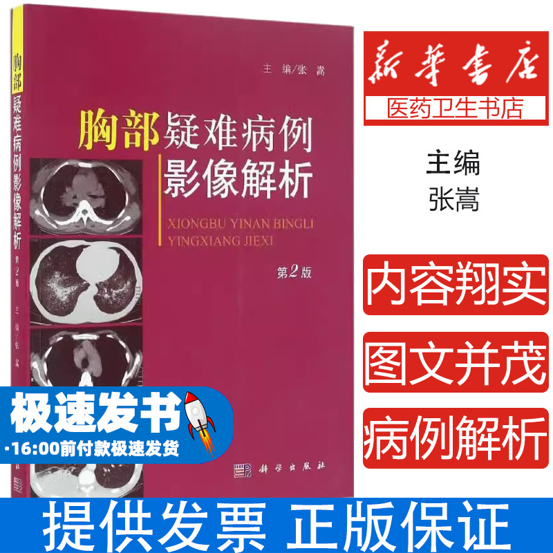胸部疑难病例影像解析（第2版）张嵩科学出版社9787030496324医学卫生/影像医学