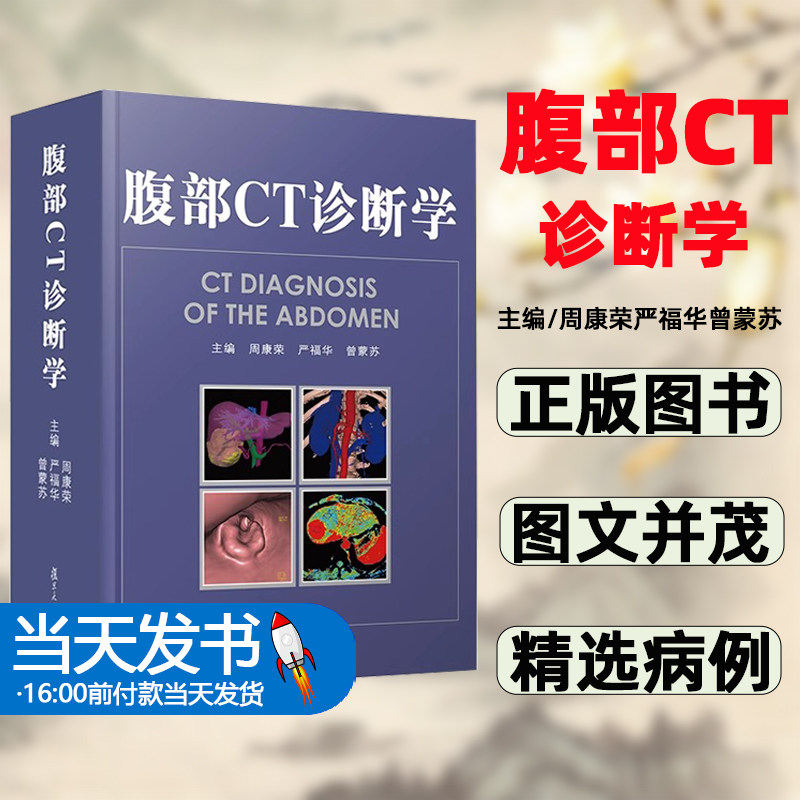 腹部CT诊断医学影像临床诊断