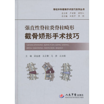 强直性脊柱炎脊柱畸形截骨矫形手术技巧梁益建等编人民军医出版社9787509171301医学卫生/外科学