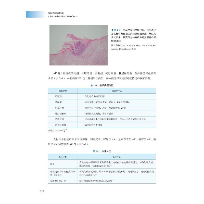 皮肤癌实用指南(美)艾莉森·汉伦中国科学技术出版社9787504692252医学卫生/皮肤病学/性病学