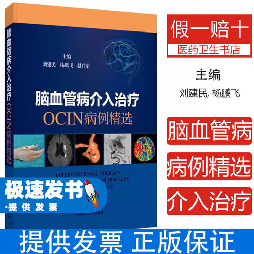 脑血管病介入治疗:OCIN病例精选刘建民, 杨鹏飞, 赵开军, 主编上海科学技术出版社9787547873052医学卫生/临床医学