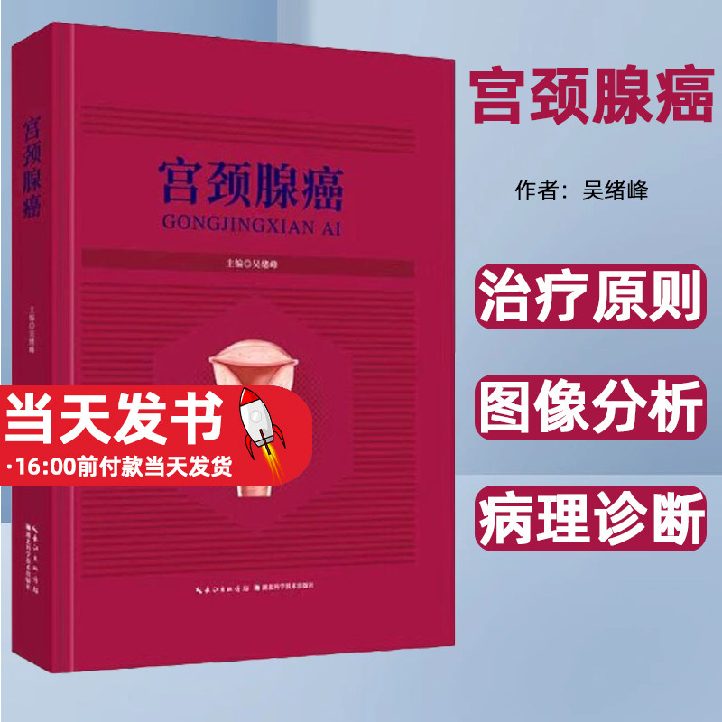 宫颈腺癌精吴绪峰湖北科学技术