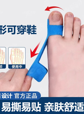 脚趾固定贴大脚趾防外翻绷一次性
