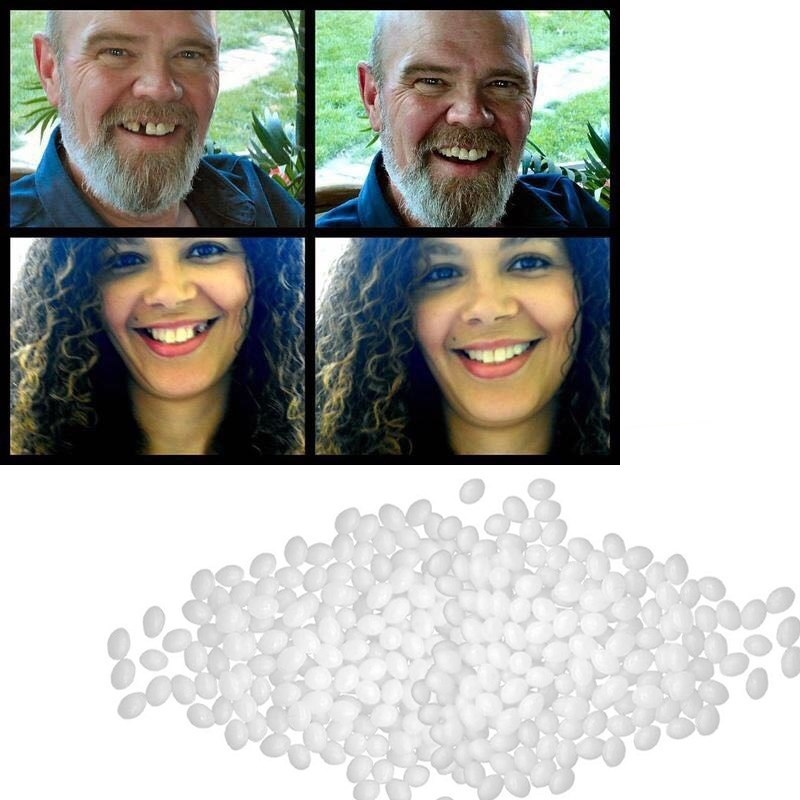 Tooth-Repair-Set Glue Denture Adhesive Dentist False-Teeth R