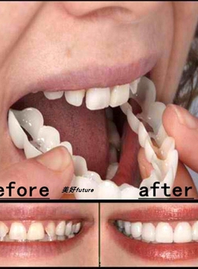 Snap On Tooth Flex Teeth Whitening Smile False Teeth Cover