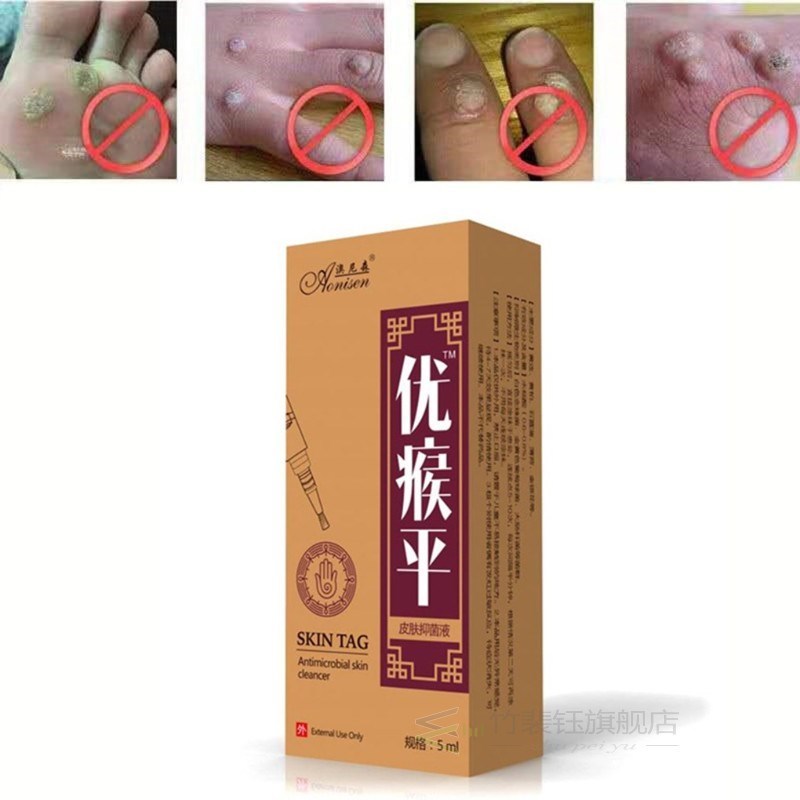 Body-Warts-Removal-Cream Skin-Tag-Remover Foot-Care 5ML 1-Bo