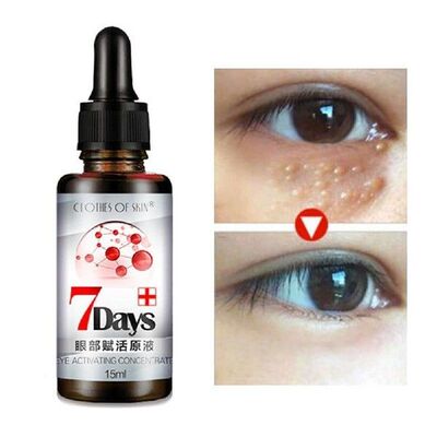New Eye Revitalizing Solution Dilute Dark Circles Remove