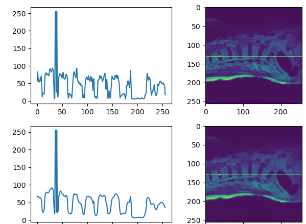 DL00422-脊柱疾病智能诊断Unet关键点检测＋resNet分类