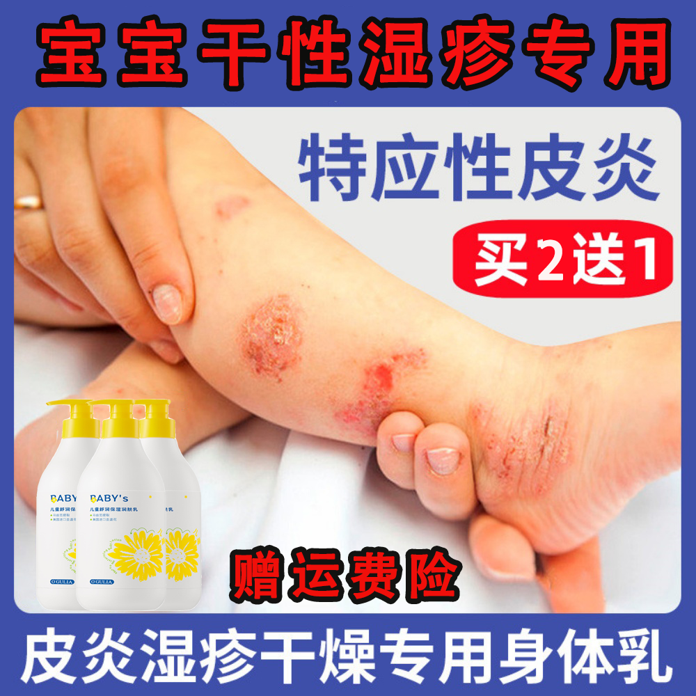 宝宝身体乳干性湿疹皮肤干燥止痒去保湿新生根婴儿润肤乳儿童秋冬