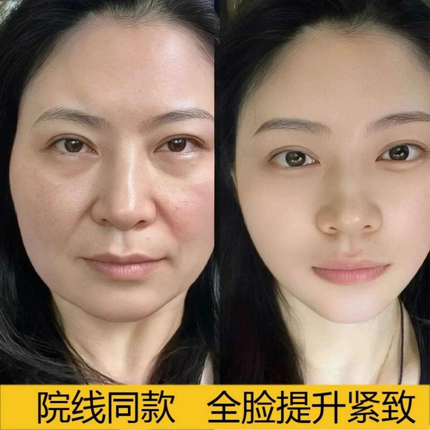 【美容院同款】提拉紧致面膜胶原蛋白抗皱淡化法令纹小V脸神器