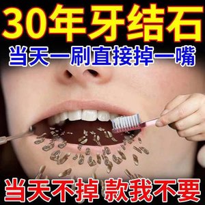 牙齿美白神器洗牙粉变白速效除牙石污垢去黄牙洁洗白亮白去牙结石