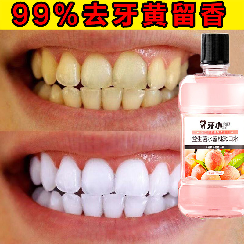 漱口水杀菌除口臭持久留香洗牙齿变美白去黄污垢除清洁神器便捷装
