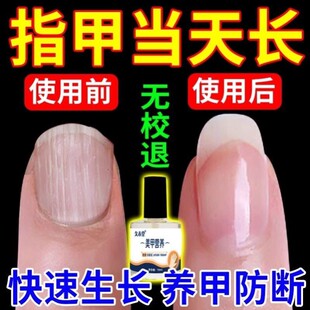 指甲快速生长液甲床受损啃咬倒刺指甲营养液变硬增厚护甲修复油