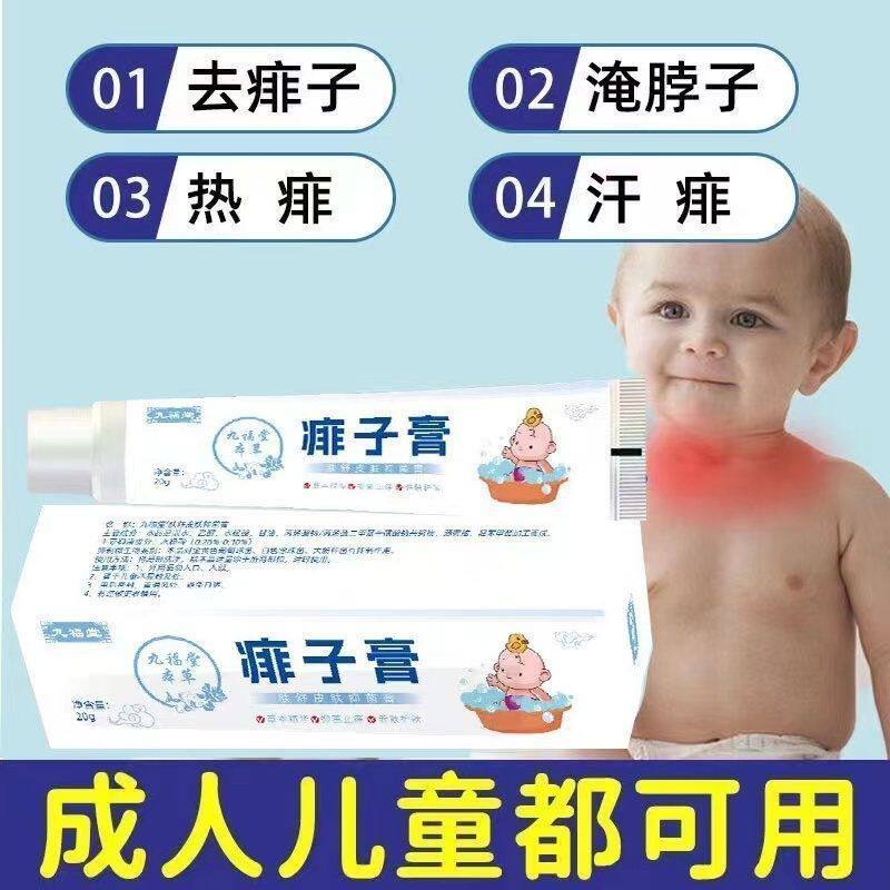 痱子药I膏去痱子止痒宝宝长热痱特i效药皮肤瘙痒根去炉甘石软膏