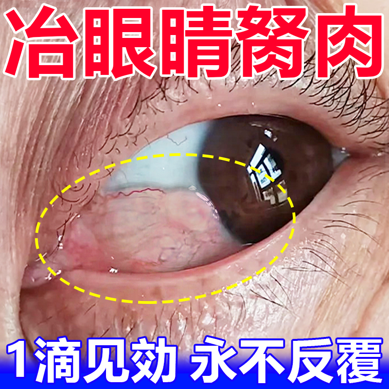 小红书推荐治眼睛芷涩护眼液