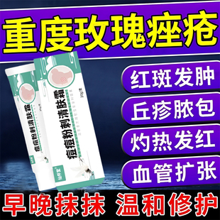 玫瑰痤疮特效药屏障修复软膏祛痘重度暗疮酒糟鼻闭口粉刺专用药膏