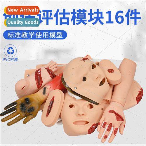 Advanced Trauma Assessment Module Wearable Burn Trauma Surge