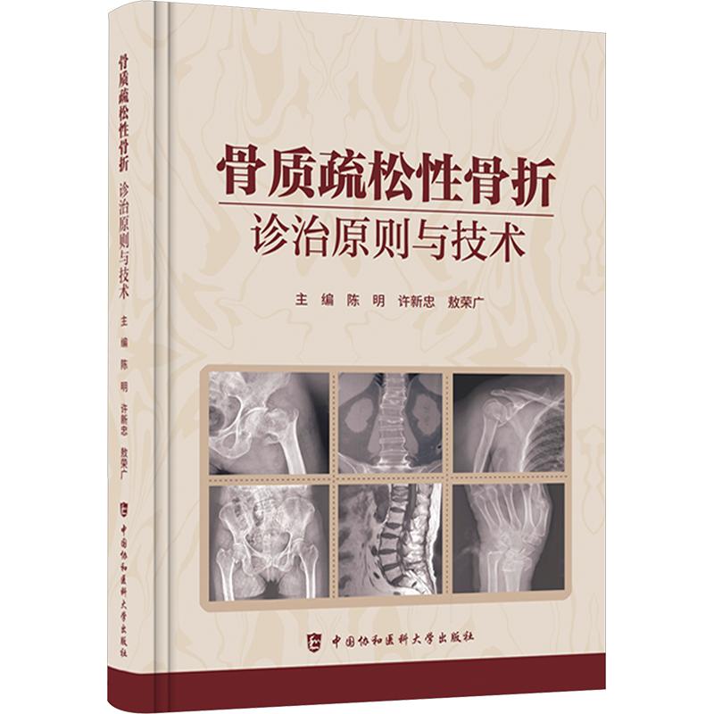 骨质疏松骨折——诊治原则与技术 骨质疏松骨折 诊治原则详解 临床操作技术 骨科医学教材 医师参考用书 9787567929128