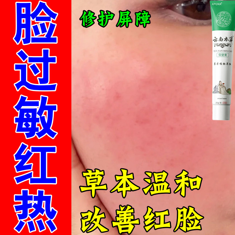 脸蛋敏感红肿发痒脱皮灼热春秋泛红不适植萃精华修护软膏