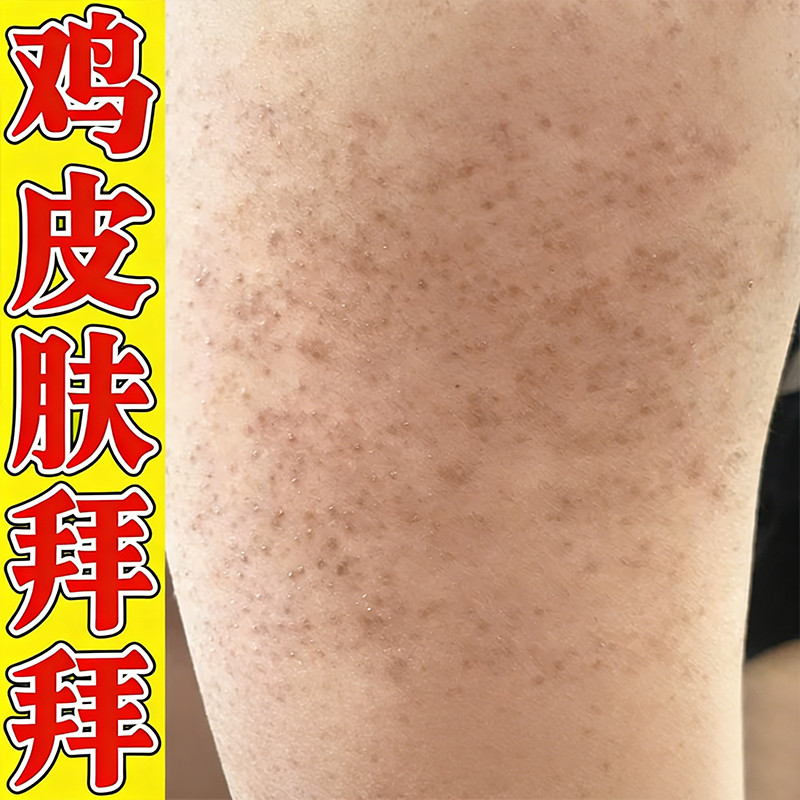腿上密密麻麻小黑点疙瘩身上毛囊受损祛鸡皮修护鸡皮小颗粒