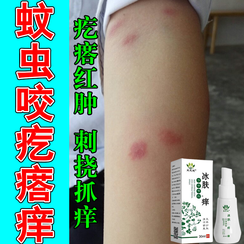 宝宝身上红疙瘩蚊虫叮咬痒肿痒喷剂身上起红疙瘩红肿打包草本喷剂
