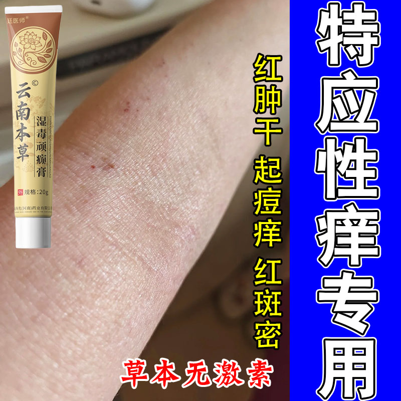 特应性皮肤疙瘩发痒难耐专用胳膊肘窝痒干燥红肿痒保湿修护膏