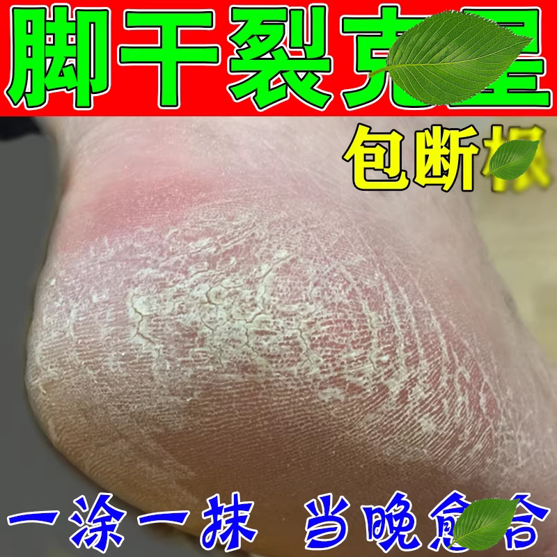 专冶脚裂脚后跟足跟干裂口起硬皮开裂膏脱皮修复霜
