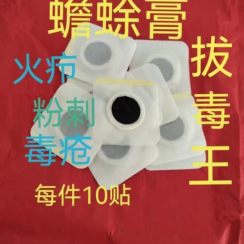 蟾蜍膏药毒疮腮腺消粉刺青春豆拔毒酥蛤蟆酥痤疮10贴装