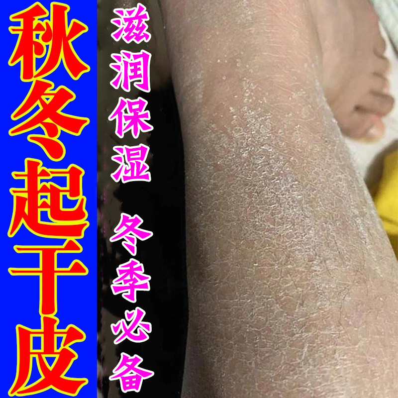 秋冬皮肤干燥起皮起屑护肤甘油