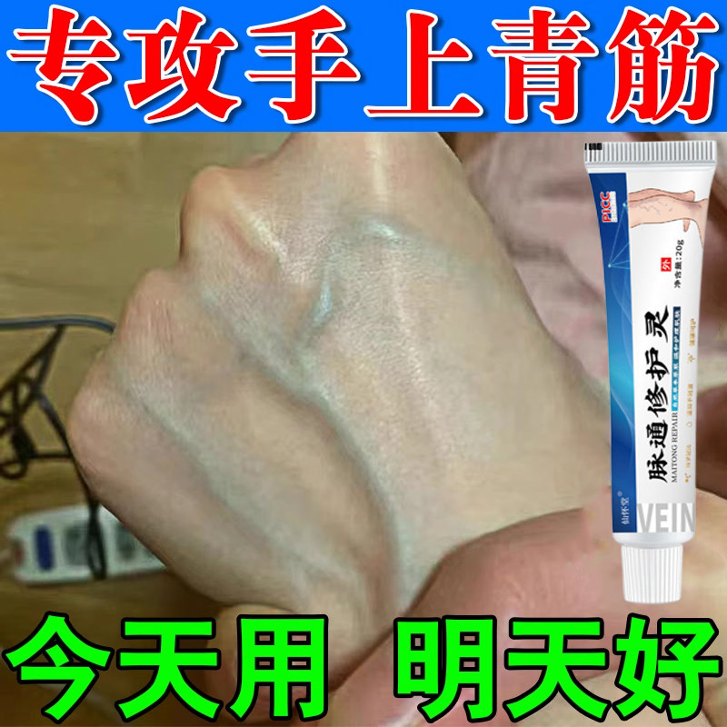 手背青筋凸起血管扩张红血丝血管堵塞肿胀疼痛
