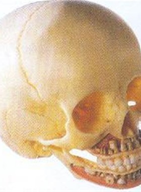 儿童头颅骨模型A11114