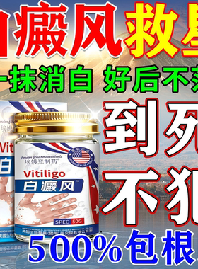 万康得白斑膏白风癜特药效膏快速消白斑专用促黑色素生长外用软膏