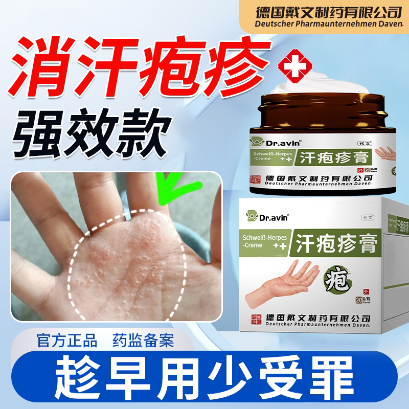 汗状疱i疹专i用软膏手上起小水皮肤消毒护理（消）