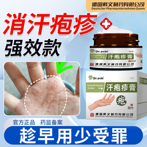 汗状疱i疹专i用软膏手上起小水泡汗状止痒汉状真菌感染干裂药WT