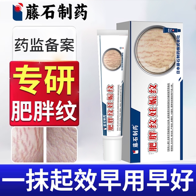 肥胖纹修复霜去除肥胖纹生长纹消除大腿修复膏学生青少年ZR