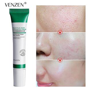 20ml Salicylic Acid Pores Refining Cream Shrink Pore Improve