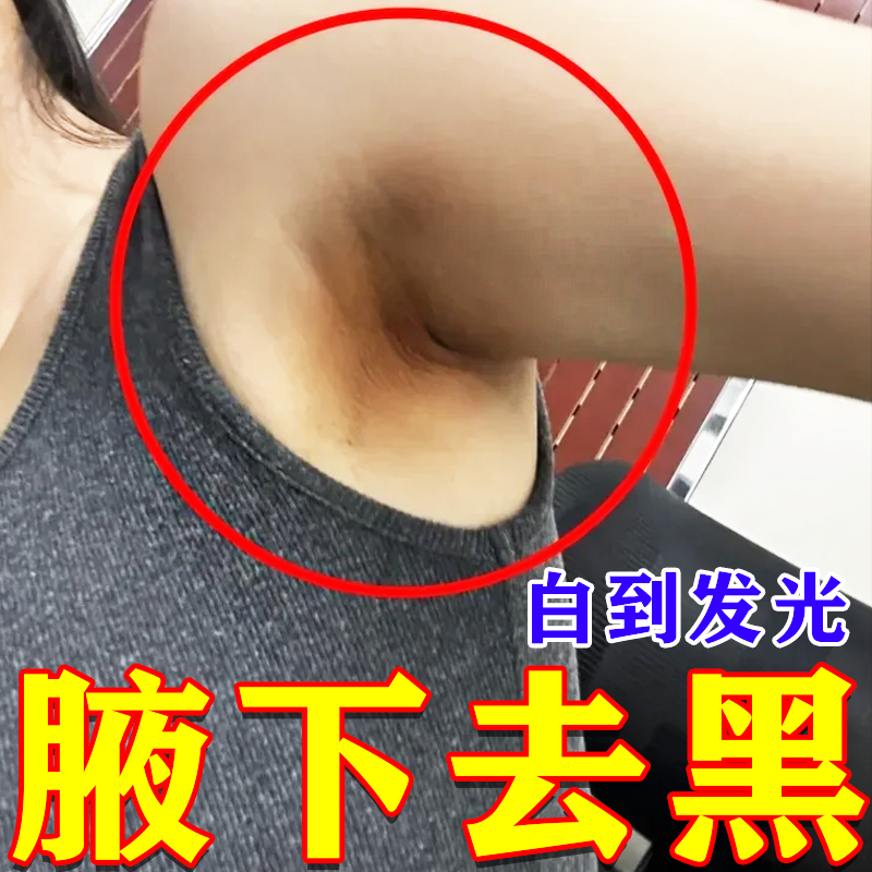 腋下去黑美白腋窝黑色素棘皮脖子沉淀屁股坐印去除手关节膝盖神器