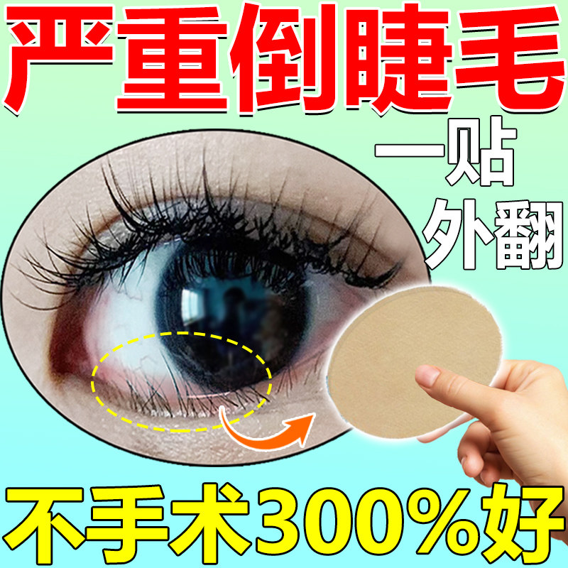 倒睫毛矫正贴神器日本儿童成人上眼睑下垂外翻提拉下睫毛眼贴专用,彩妆/香水/美妆工具,化妆/美容工具,淘宝优惠券,粉丝福利购,淘宝优惠卷